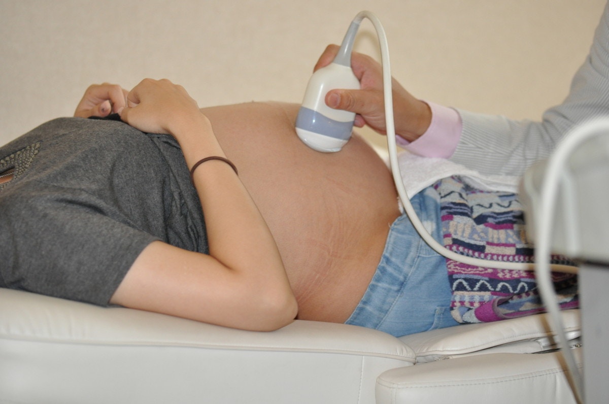 医療監修 横位は出産までに直る 治療方法と出産方法 体験談をご紹介 ママリ