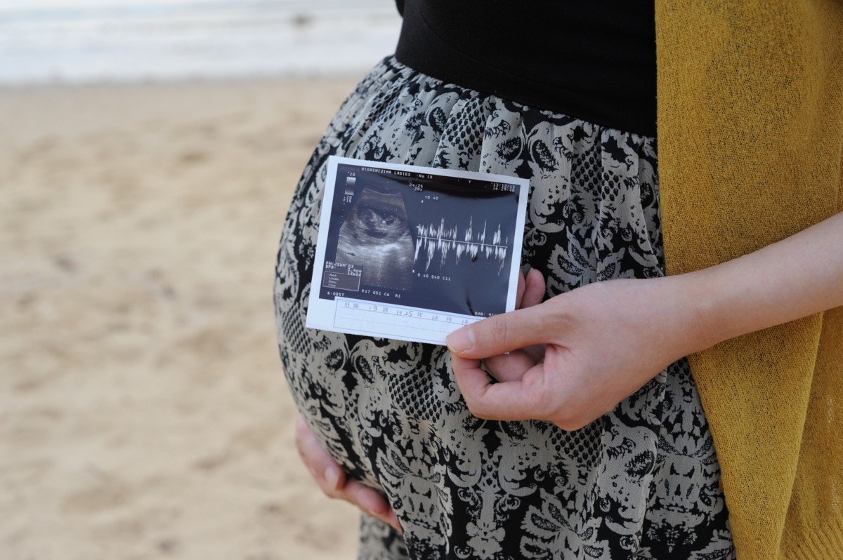 2ページ目 医療監修 エコー写真を妊娠の経過別に紹介 写真の見方や性別の見分け方 ママリ