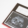【医療監修】エコー写真を妊娠の経過別に紹介！写真の見方や性別の見分け方