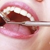 虫歯の放置はリスクが高い、妊娠をきっかけに歯科健診の習慣を