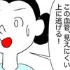 逃げる血管？先輩ナースでも難しい注射は無事終わる？｜20代で片方の卵巣が半分になった話