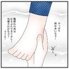 【ただの腫れじゃない？】足首が赤く腫れる異変、3歳娘の様子がおかしい
