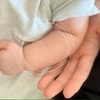 「これはもしかして…」赤ちゃんの腕に出た“兆し”に気づいた母に5000いいね「うちの子も」「期待大」