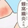 その足の痛み、「こむら返り」じゃないかも…3歳児を襲った"蜂窩織炎"とは？