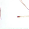 【謎のブツブツに要注意】毛虫被害の注意喚起に1.6万いいね「現場で使える工夫」「大事な注意喚起」