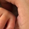 【ほっこり】赤ちゃんの指に残る愛らしい『跡』に1.2万いいね「かわいすぎる」「面白いね」