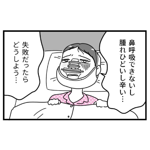 過酷なダウンタイム乗り越え→整形で得た【自分を愛せる】という喜び｜初めての彼氏に裏切られて整形した話