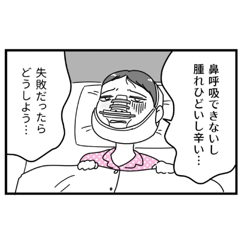 過酷なダウンタイム乗り越え→整形で得た【自分を愛せる】という喜び｜初めての彼氏に裏切られて整形した話