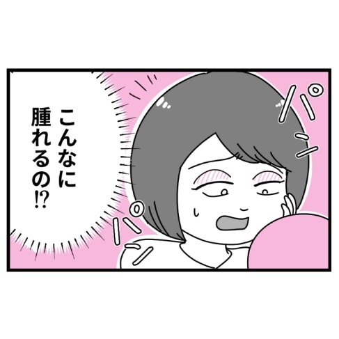 手術台で涙→二重まぶたに整形した直後に「うそ…」予想以上の事態に｜初めての彼氏に裏切られて整形した話