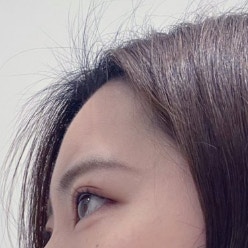 生え際あるあるが話題に！「全員友達」に14万いいね「わかりすぎて涙」「今日からあなたも仲間」