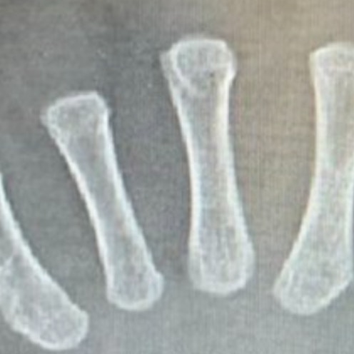 骨までいとおしい！1歳息子のレントゲン写真に2.7万いいね「かわい過ぎる」「守りたいおてて」