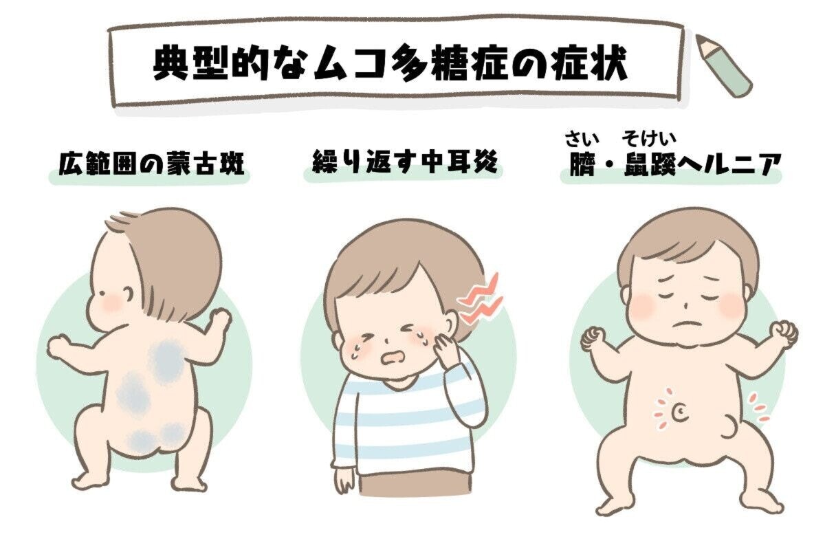 大きな蒙古斑、くり返す中耳炎やいびき…ママの直感が働いたときの相談先って？ [ママリ]