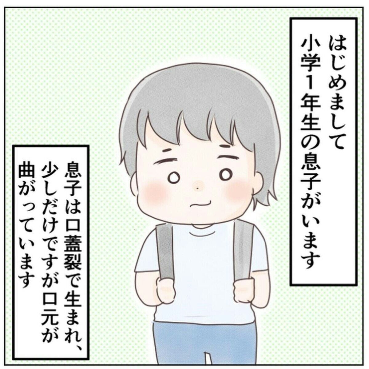 先天性の違いをからかう上級生、わが子へのからかいに母親がついにキレる [ママリ]