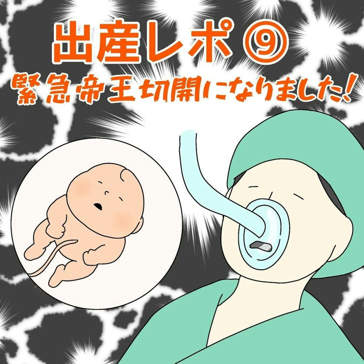 帝王切開術 : 基本と応用まるごとマスター 破水した赤ちゃんは?緊急帝王切開で麻酔注入直後、母の身体に
