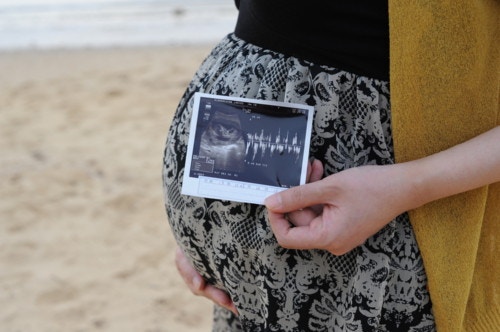 2ページ目 医療監修 妊娠33週目 妊婦は貧血に気をつけて 胎児は呼吸の練習をしています ママリ