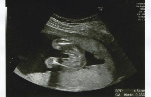 2ページ目 医療監修 妊娠初期から臨月までの胎児の成長 身長と体重の目安は ママリ