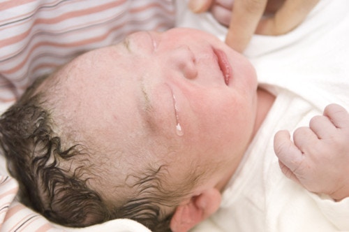 医療監修 乳児湿疹とは 新生児ニキビなどの原因とスキンケアの方法 ママリ