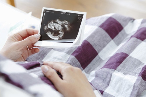 医療監修 妊娠25週目の妊婦さんに起こりやすい症状と 胎児の様子 ママリ